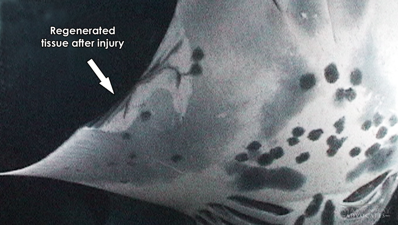 Doug Ray's scars