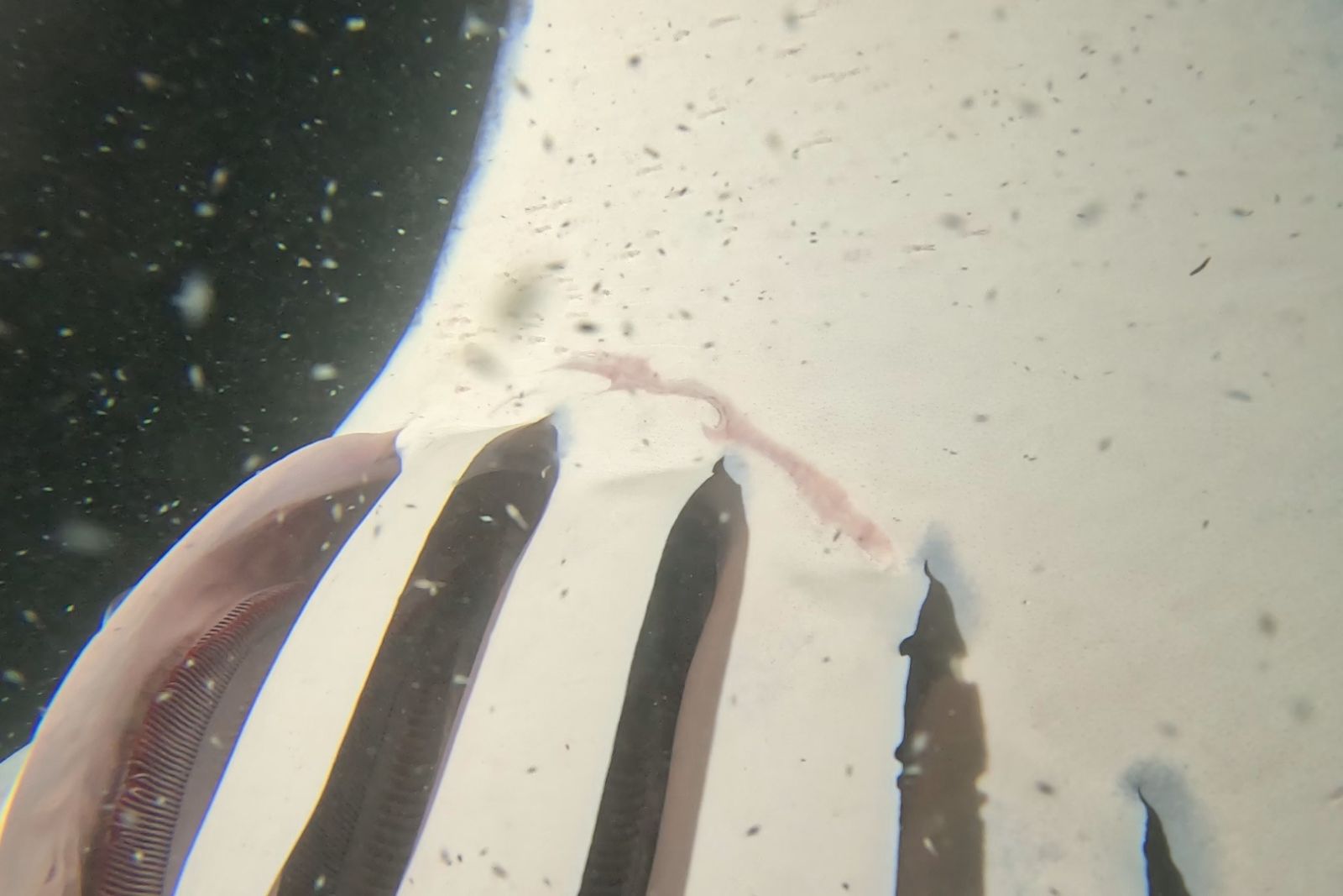 Otho Dee Ray Recovery from his injures